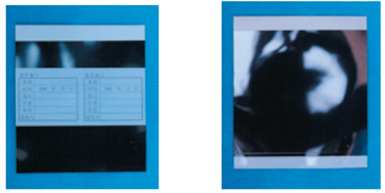 黑色衬底掌纹提取胶片